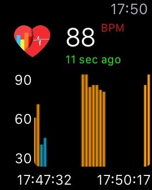 Kép: A Cardiogram képernyője az Apple Watch-on.
