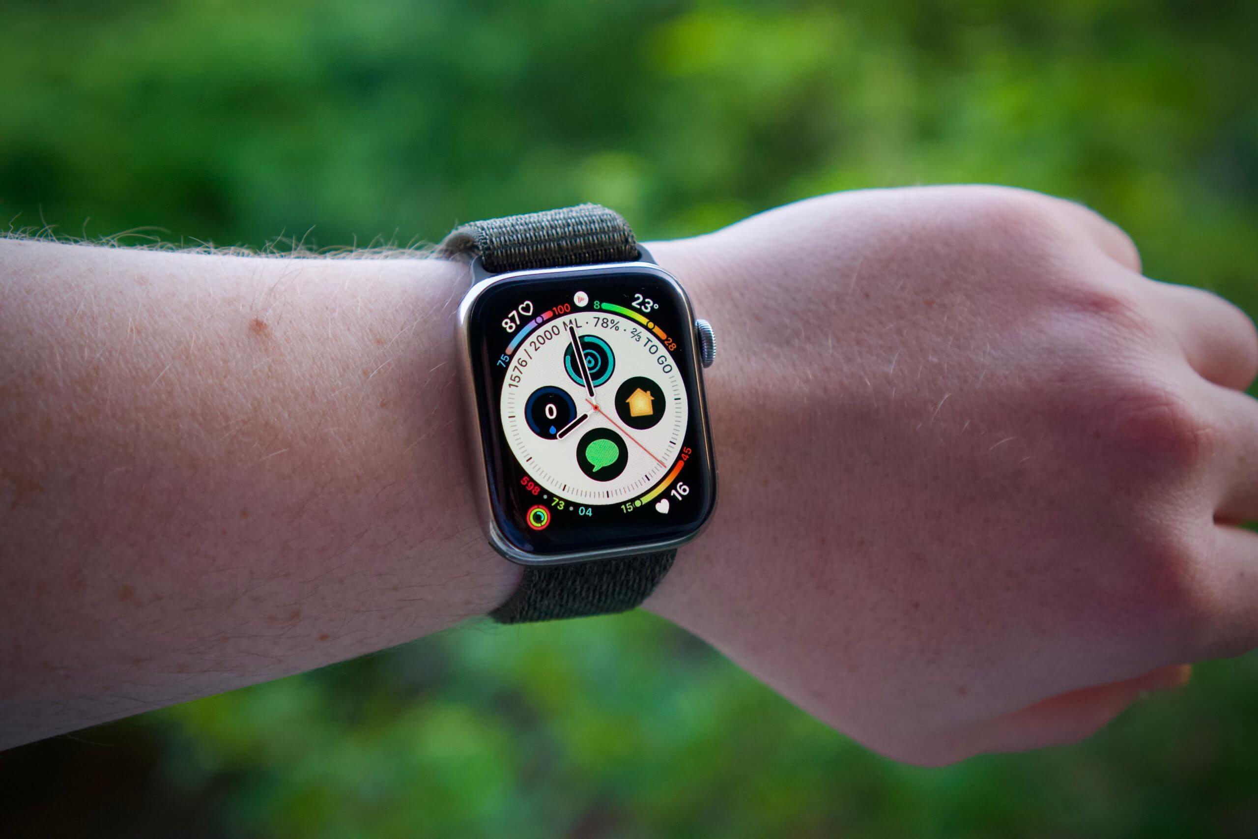 Középpontban az egészségünk – avagy ilyen számlapot használok az Apple Watch-omon